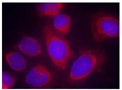 Immunocytochemistry/ Immunofluorescence - Anti-CPI-17 antibody (AB131451)