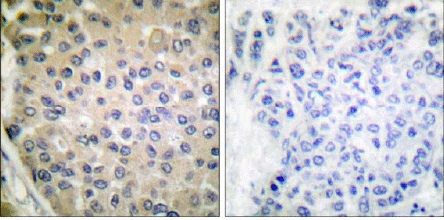 Immunohistochemistry (Formalin/PFA-fixed paraffin-embedded sections) - Anti-CPI-17 (phospho T38) antibody (AB52174), expandable thumbnail