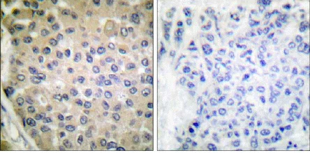 Immunohistochemistry (Formalin/PFA-fixed paraffin-embedded sections) - Anti-CPI-17 (phospho T38) antibody (AB52174)