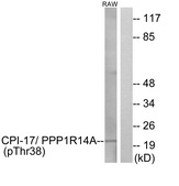 Western blot - Anti-CPI-17 (phospho T38) antibody (AB52174), expandable thumbnail