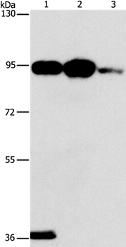 Western blot - Anti-cPLA2 beta antibody (AB198898), expandable thumbnail