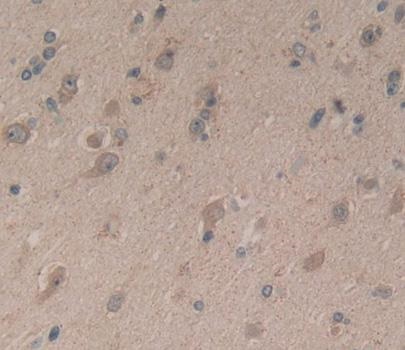 Immunohistochemistry (Formalin/PFA-fixed paraffin-embedded sections) - Anti-CPLX1 antibody (AB231347)