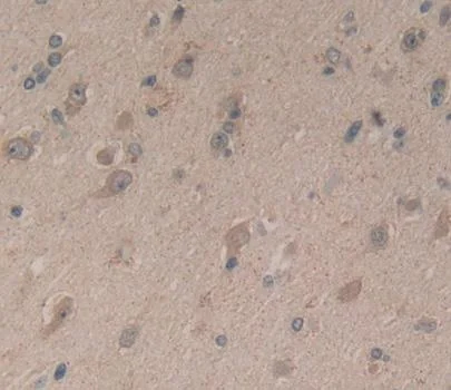 Immunohistochemistry (Formalin/PFA-fixed paraffin-embedded sections) - Anti-CPLX1 antibody (AB231347)