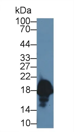 Western blot - Anti-CPLX1 antibody (AB231347)