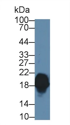 Western blot - Anti-CPLX1 antibody (AB231347)