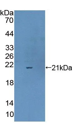 Western blot - Anti-CPLX1 antibody (AB231347)