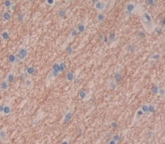 Immunohistochemistry (Formalin/PFA-fixed paraffin-embedded sections) - Anti-CPLX2 antibody (AB232895)