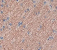 Immunohistochemistry (Formalin/PFA-fixed paraffin-embedded sections) - Anti-CPLX2 antibody (AB232895)