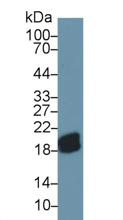 Western blot - Anti-CPLX2 antibody (AB232895)