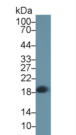 Western blot - Anti-CPLX2 antibody (AB232895)