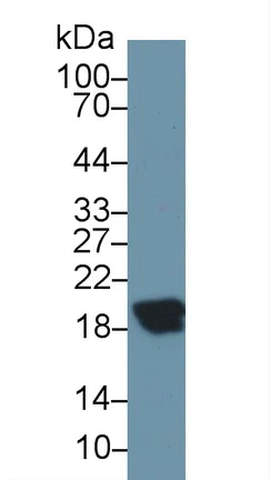 Western blot - Anti-CPLX2 antibody (AB232895)