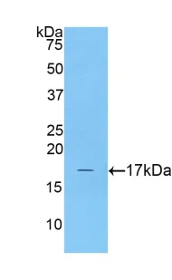 Western blot - Anti-CPLX2 antibody (AB232895)