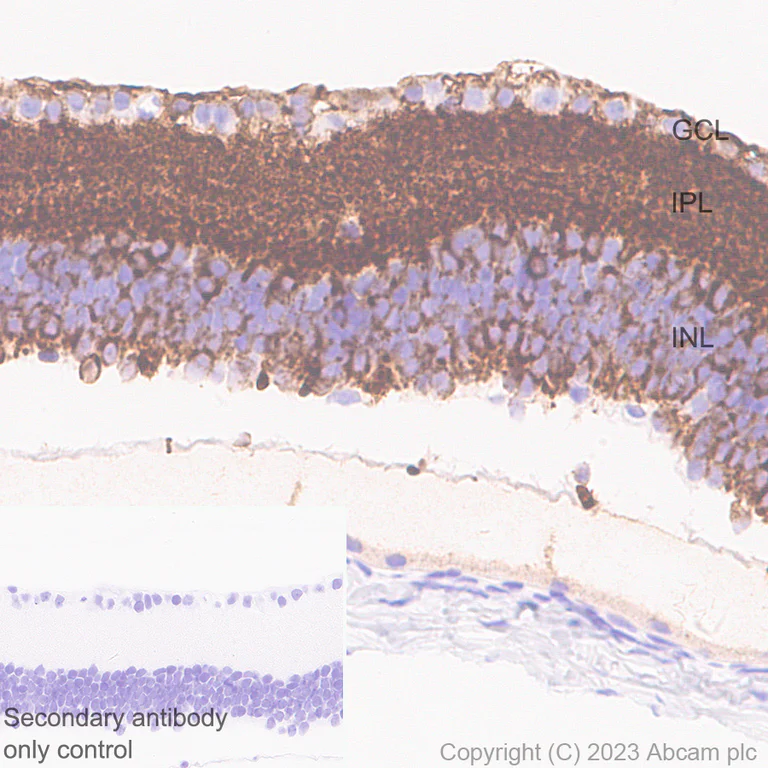 Immunohistochemistry (Formalin/PFA-fixed paraffin-embedded sections) - Anti-CPLX3 antibody [EPR28433-43] (AB308463)