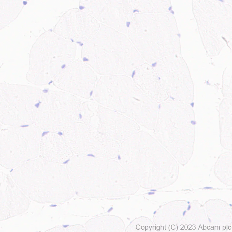 Immunohistochemistry (Formalin/PFA-fixed paraffin-embedded sections) - Anti-CPLX3 antibody [EPR28433-43] (AB308463)