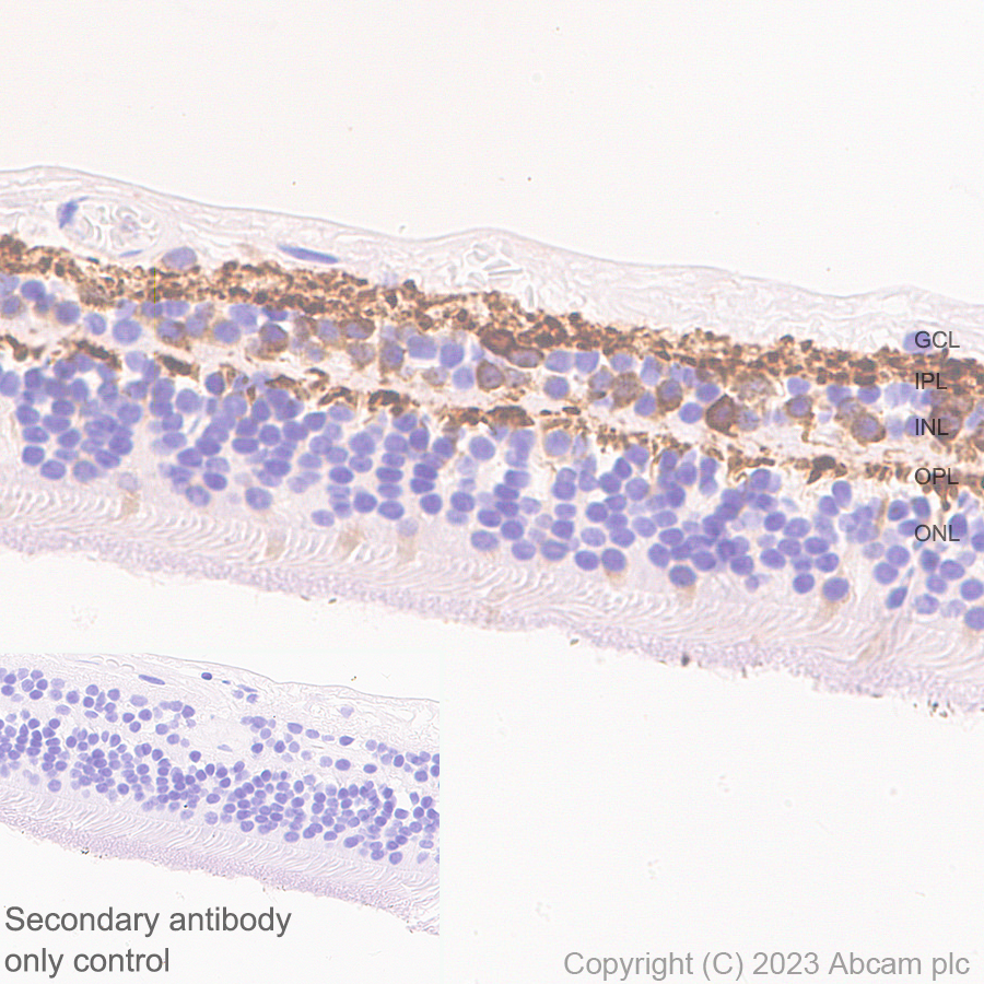 Immunohistochemistry (Formalin/PFA-fixed paraffin-embedded sections) - Anti-CPLX3 antibody [EPR28433-43] - BSA and Azide free (ab308464), expandable thumbnail