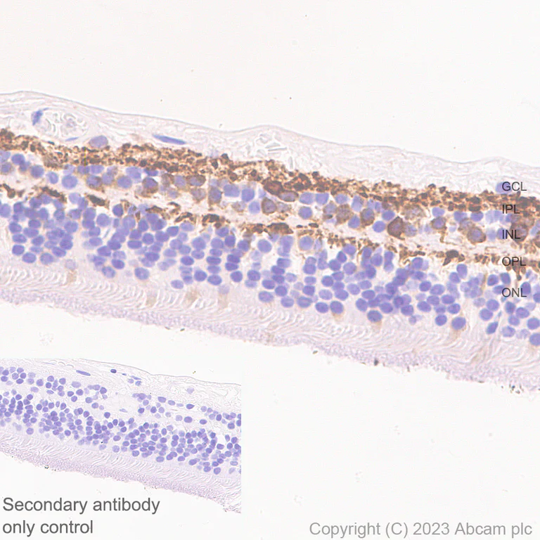 Immunohistochemistry (Formalin/PFA-fixed paraffin-embedded sections) - Anti-CPLX3 antibody [EPR28433-43] - BSA and Azide free (AB308464)