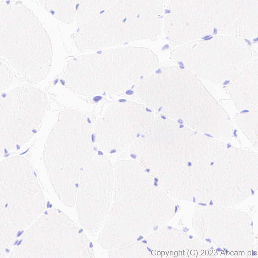 Immunohistochemistry (Formalin/PFA-fixed paraffin-embedded sections) - Anti-CPLX3 antibody [EPR28433-43] - BSA and Azide free (ab308464), expandable thumbnail