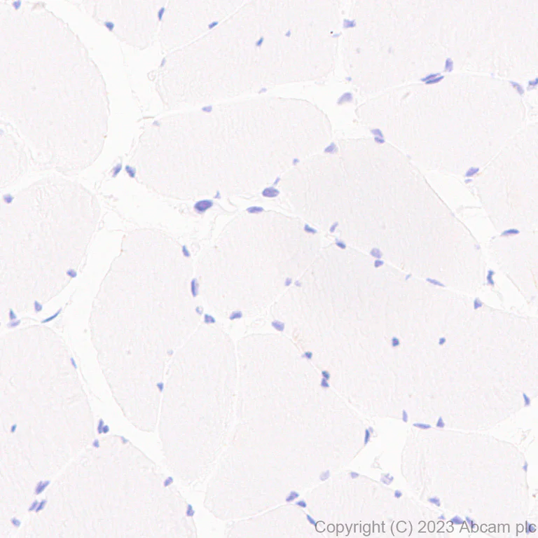 Immunohistochemistry (Formalin/PFA-fixed paraffin-embedded sections) - Anti-CPLX3 antibody [EPR28433-43] - BSA and Azide free (AB308464)