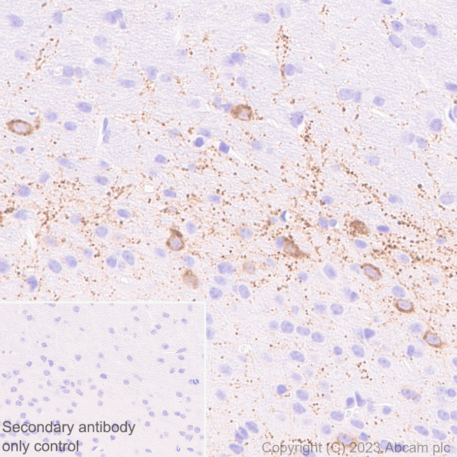Immunohistochemistry (Formalin/PFA-fixed paraffin-embedded sections) - Anti-CPLX3 antibody [EPR28433-43] - BSA and Azide free (AB308464), expandable thumbnail