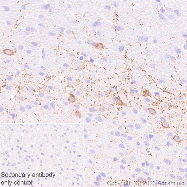 Immunohistochemistry (Formalin/PFA-fixed paraffin-embedded sections) - Anti-CPLX3 antibody [EPR28433-43] - BSA and Azide free (AB308464)