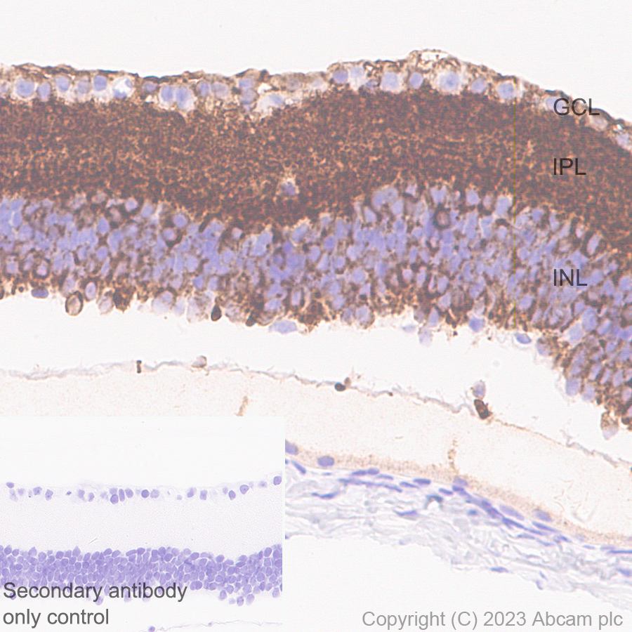 Immunohistochemistry (Formalin/PFA-fixed paraffin-embedded sections) - Anti-CPLX3 antibody [EPR28433-43] - BSA and Azide free (ab308464), expandable thumbnail
