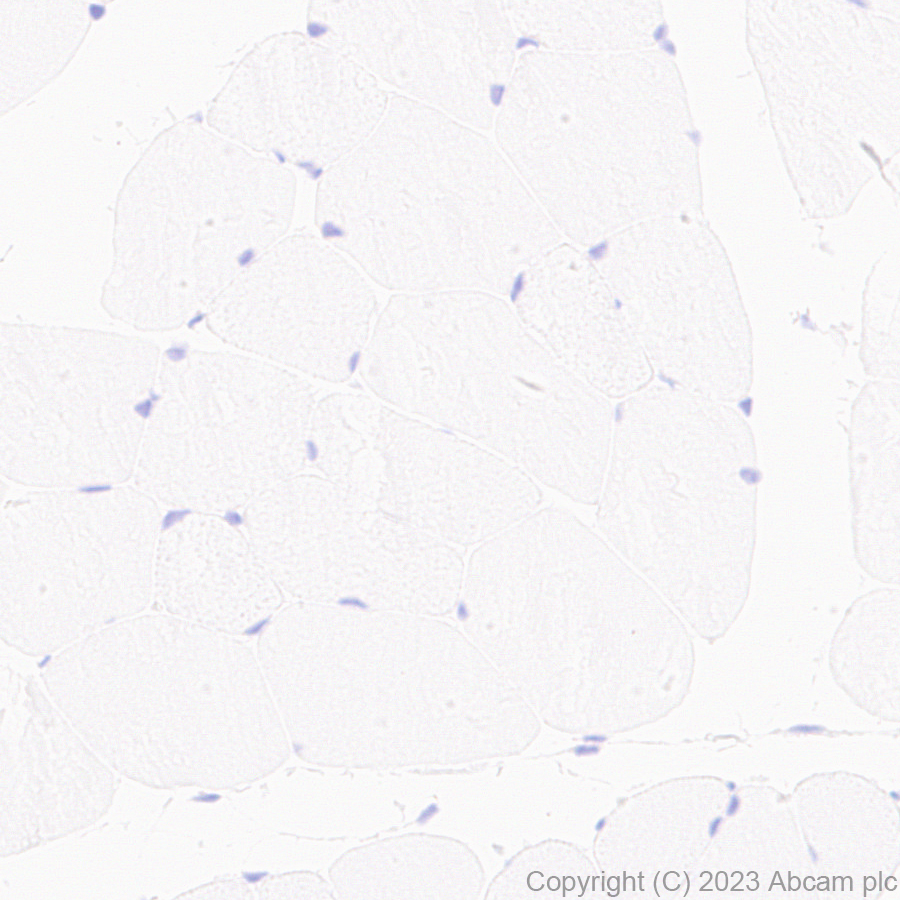 Immunohistochemistry (Formalin/PFA-fixed paraffin-embedded sections) - Anti-CPLX3 antibody [EPR28433-43] - BSA and Azide free (AB308464), expandable thumbnail