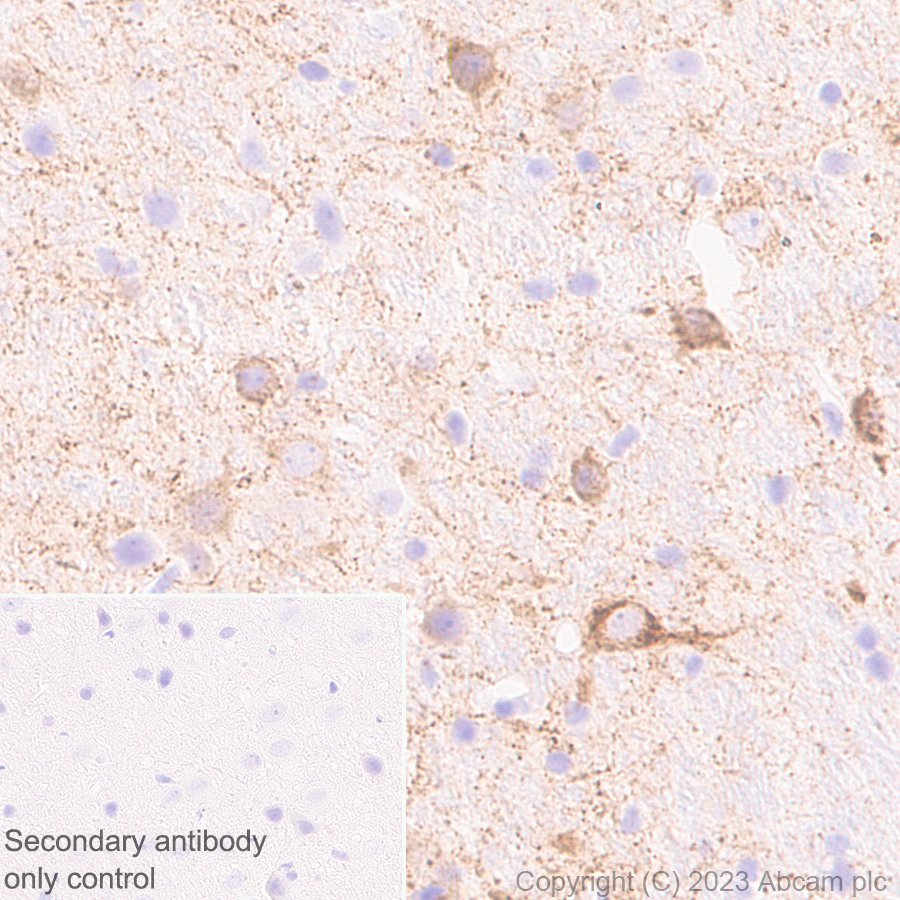 Immunohistochemistry (Formalin/PFA-fixed paraffin-embedded sections) - Anti-CPLX3 antibody [EPR28433-43] - BSA and Azide free (AB308464), expandable thumbnail