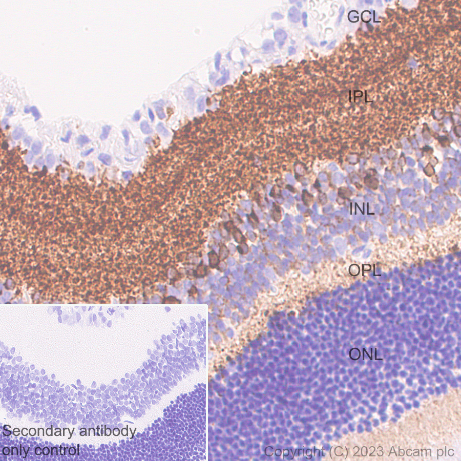 Immunohistochemistry (Formalin/PFA-fixed paraffin-embedded sections) - Anti-CPLX3 antibody [EPR28433-43] - BSA and Azide free (AB308464), expandable thumbnail