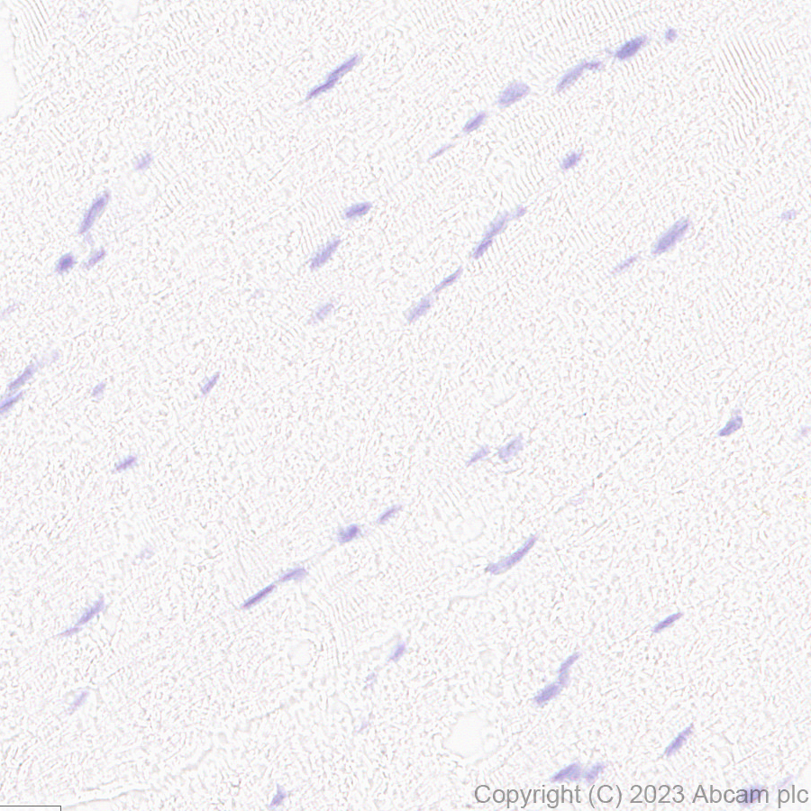 Immunohistochemistry (Formalin/PFA-fixed paraffin-embedded sections) - Anti-CPLX3 antibody [EPR28433-43] - BSA and Azide free (ab308464), expandable thumbnail