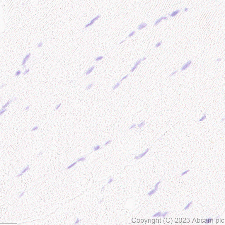 Immunohistochemistry (Formalin/PFA-fixed paraffin-embedded sections) - Anti-CPLX3 antibody [EPR28433-43] - BSA and Azide free (AB308464)