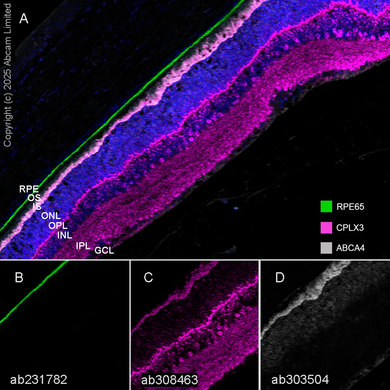 Multiplex immunohistochemistry - Anti-CPLX3 antibody [EPR28433-43] - BSA and Azide free (AB308464)