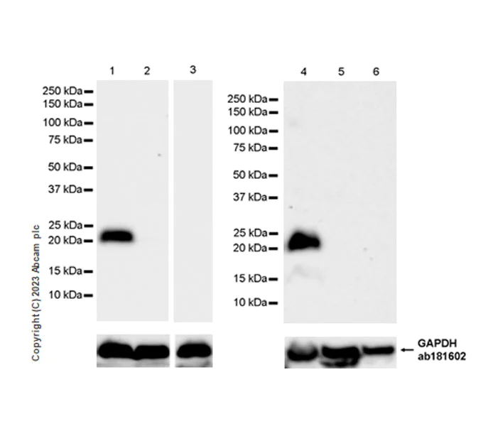 Western blot - Anti-CPLX3 antibody [EPR28433-43] - BSA and Azide free (AB308464)