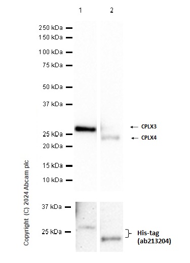 Western blot - Anti-CPLX3 antibody [EPR28433-43] - BSA and Azide free (AB308464), expandable thumbnail