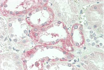 Immunohistochemistry (Formalin/PFA-fixed paraffin-embedded sections) - Anti-CPM antibody (AB230868)