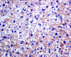 Immunohistochemistry (Formalin/PFA-fixed paraffin-embedded sections) - Anti-CPM antibody [EPR8052] (AB150405)