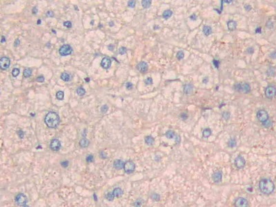Immunohistochemistry (Formalin/PFA-fixed paraffin-embedded sections) - Anti-CPN1 antibody (AB232802)