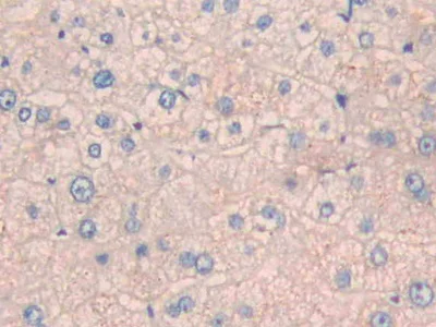 Immunohistochemistry (Formalin/PFA-fixed paraffin-embedded sections) - Anti-CPN1 antibody (AB232802)