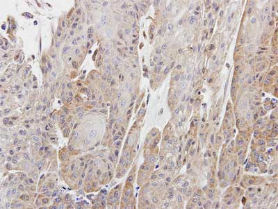 Immunohistochemistry (Formalin/PFA-fixed paraffin-embedded sections) - Anti-CPNE1 antibody (AB155675)