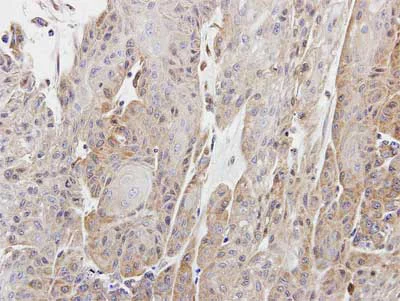 Immunohistochemistry (Formalin/PFA-fixed paraffin-embedded sections) - Anti-CPNE1 antibody (AB155675)