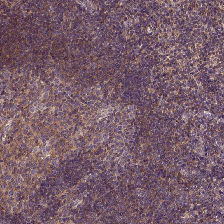 Immunohistochemistry (Formalin/PFA-fixed paraffin-embedded sections) - Anti-CPNE1 antibody (AB272682)