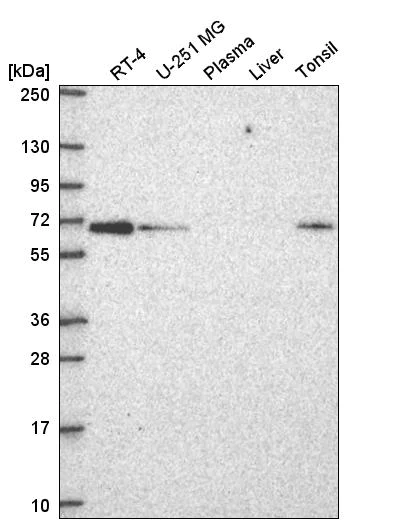 Western blot - Anti-CPNE1 antibody (AB272682)