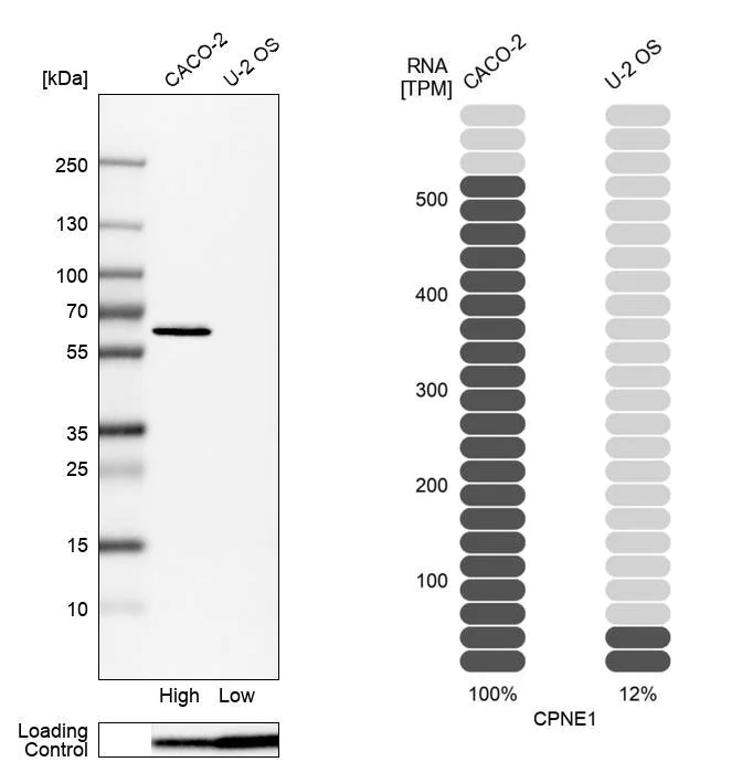 Western blot - Anti-CPNE1 antibody (AB272682)