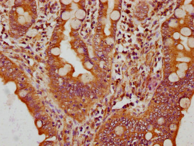 Immunohistochemistry (Formalin/PFA-fixed paraffin-embedded sections) - Anti-CPNE3 antibody (AB236606)
