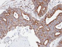 Immunohistochemistry (Formalin/PFA-fixed paraffin-embedded sections) - Anti-CPNE3 antibody (AB97919), expandable thumbnail