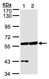 Western blot - Anti-CPNE3 antibody (AB97919), expandable thumbnail