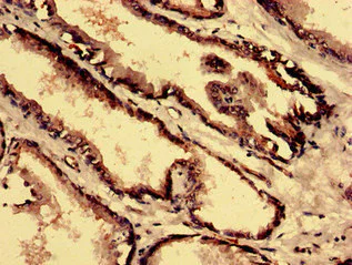 Immunohistochemistry (Formalin/PFA-fixed paraffin-embedded sections) - Anti-CPNE4 antibody (AB237627)