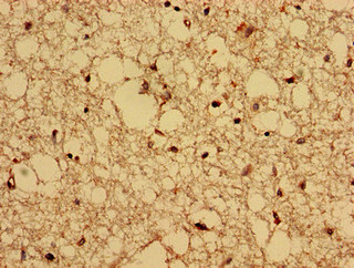 Immunohistochemistry (Formalin/PFA-fixed paraffin-embedded sections) - Anti-CPNE4 antibody (AB237627)