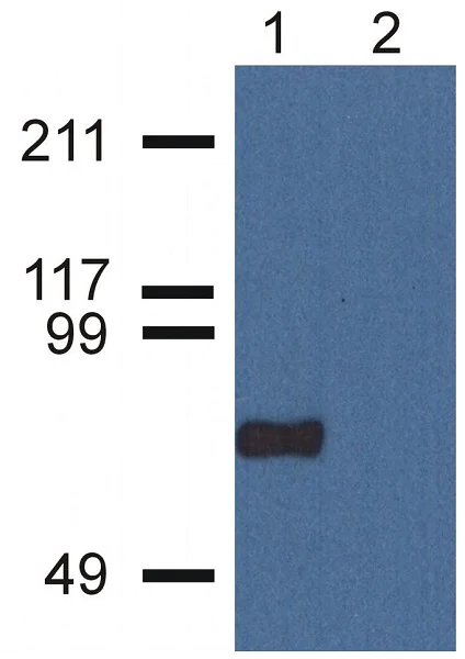 Western blot - Anti-CPNE7 antibody [CPNE7-01] (AB68547)