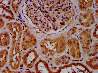 Immunohistochemistry (Formalin/PFA-fixed paraffin-embedded sections) - Anti-CPNE8 antibody (AB237541)