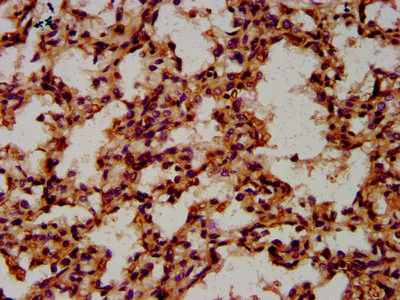Immunohistochemistry (Formalin/PFA-fixed paraffin-embedded sections) - Anti-CPNE8 antibody (AB237541)